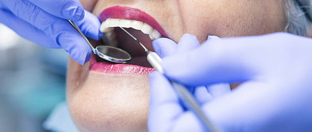 Best Emergency Tooth Extraction in Mapleton, MN
